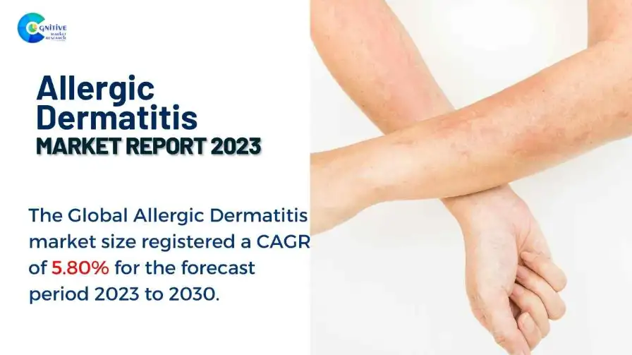 Allergic Dermatitis Market Report