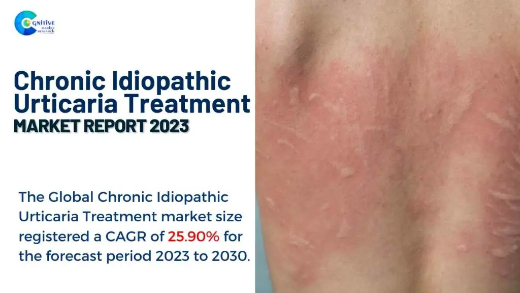 Chronic Idiopathic Urticaria Treatment Market Report