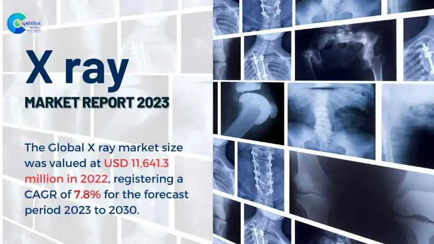 X ray Market Report